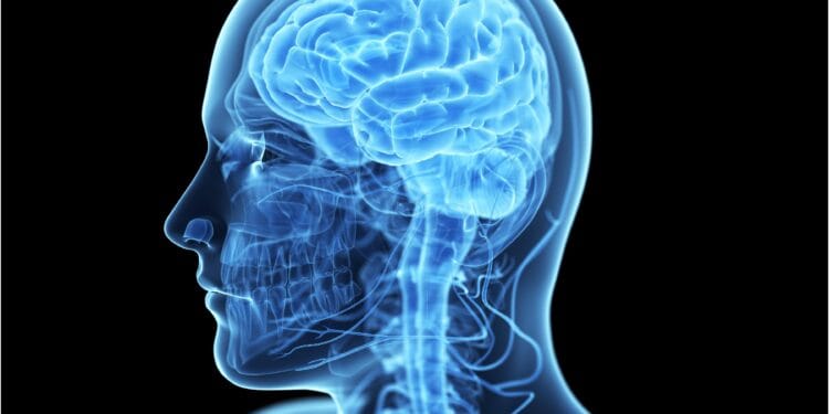 SALUD; crecen accidentes cerebrovasculares